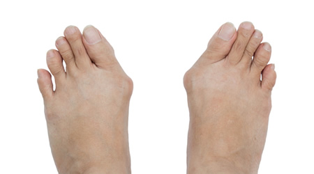 What is Big Toe Pain? Richardson Podiatry